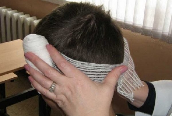 18-летний житель Брестской области во время драки проломил череп мужчине 18-летний житель Брестской области во время драки проломил череп мужчине