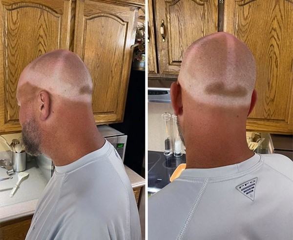 Эти фотографии показали, почему использовать солнцезащитный крем — хорошая идея! Эти фотографии показали, почему использовать солнцезащитный крем — хорошая идея!