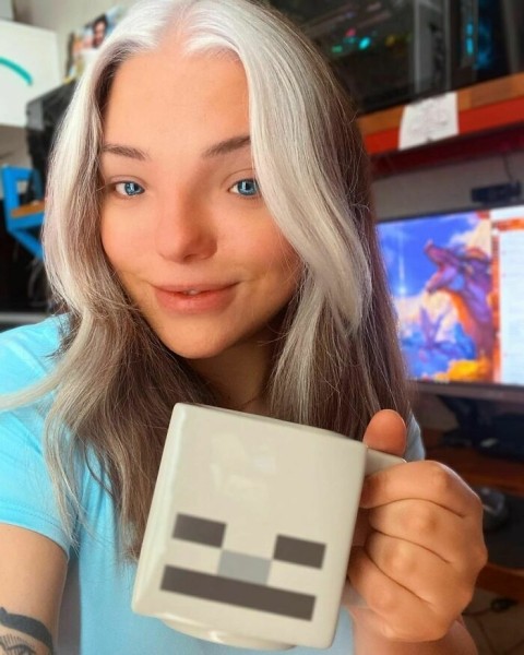 На этих фото показали, какие финты генетика вытворяет с людьми