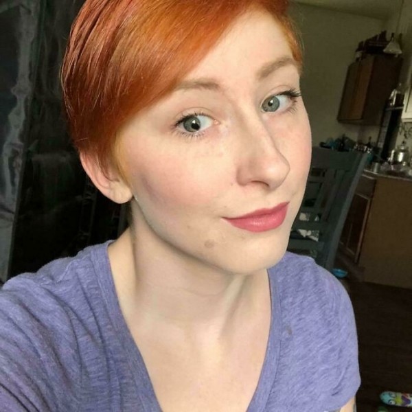 На этих фото показали, какие финты генетика вытворяет с людьми