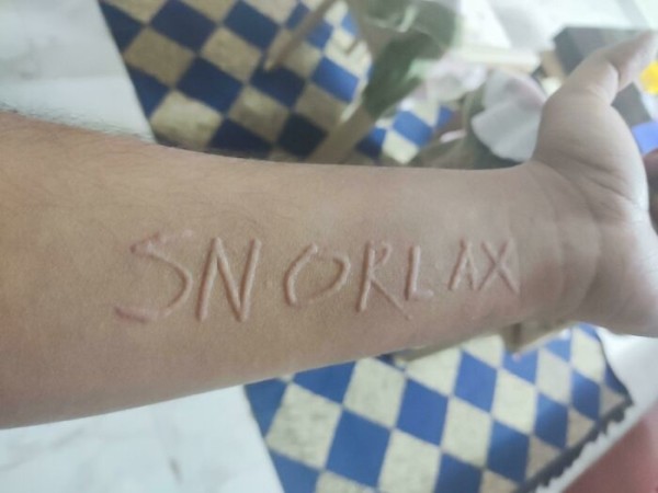 На этих фото показали, какие финты генетика вытворяет с людьми