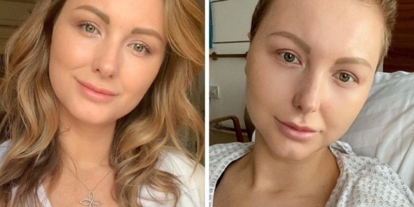 Умерла известный блогер Надя Мелешко. Она боролась с раком три года, за ее судьбой следили 500 тысяч человек