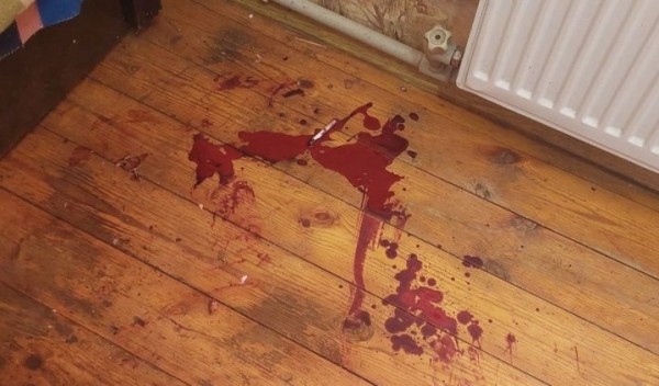 Белорус разбирал дома гранату и она взорвалась Белорус разбирал дома гранату и она взорвалась