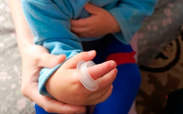 В Барановичах у ребенка застрял в трубке палец. На помощь пришли спасатели В Барановичах у ребенка застрял в трубке палец. На помощь пришли спасатели