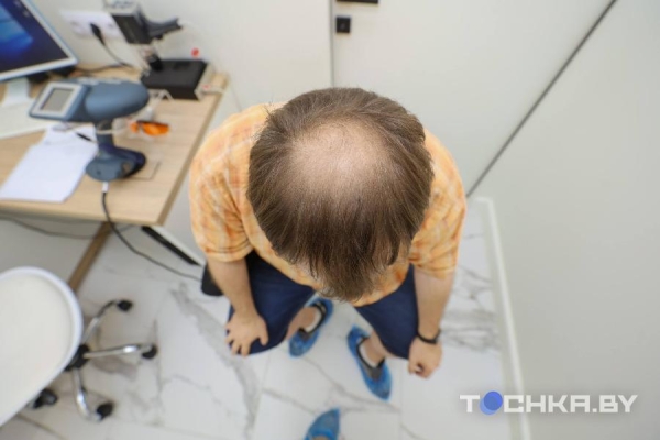 Как белорусы пересаживают волосы Как белорусы пересаживают волосы