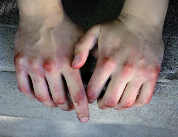 Осудили жителя Барановичей, до смерти избившего знакомую. Какой приговор Осудили жителя Барановичей, до смерти избившего знакомую. Какой приговор